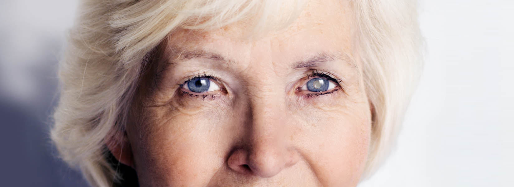 Cataract Surgery in Dallas